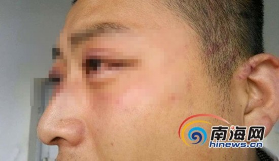 三亞一大學(xué)生稱晚歸遭保安毆打 學(xué)校稱沒這事